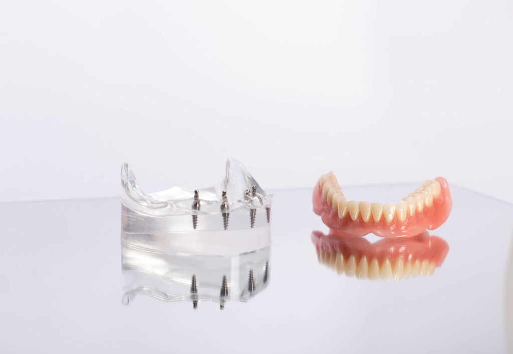 shrewsbury implant dentures